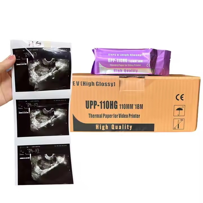Ultrasound Machine Labels Ultrasound Paper Thermal Film 75um 95um Recyclable Options for Jumbo ...