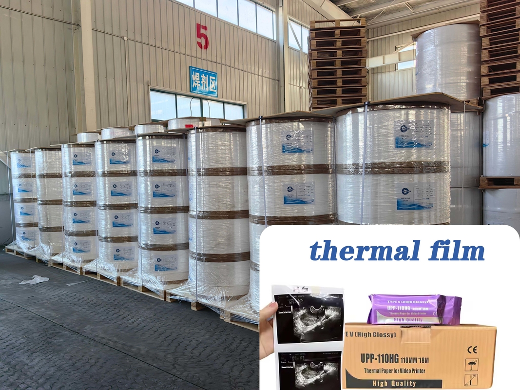 Ultimate Thermal Film for Ultrasound Paper BPA Free Durable 75um 95um Choices Tailored for Packaging Labels Jumbo Rolls
